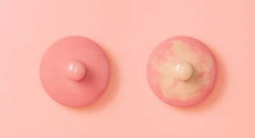 Tắc Tia Sữa Có Mủ: Nguyên Nhân, Cách Xử Lý Và Phòng Ngừa Hiệu Quả